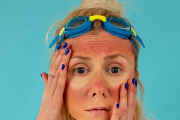 Солнечный удар. Первая помощь.